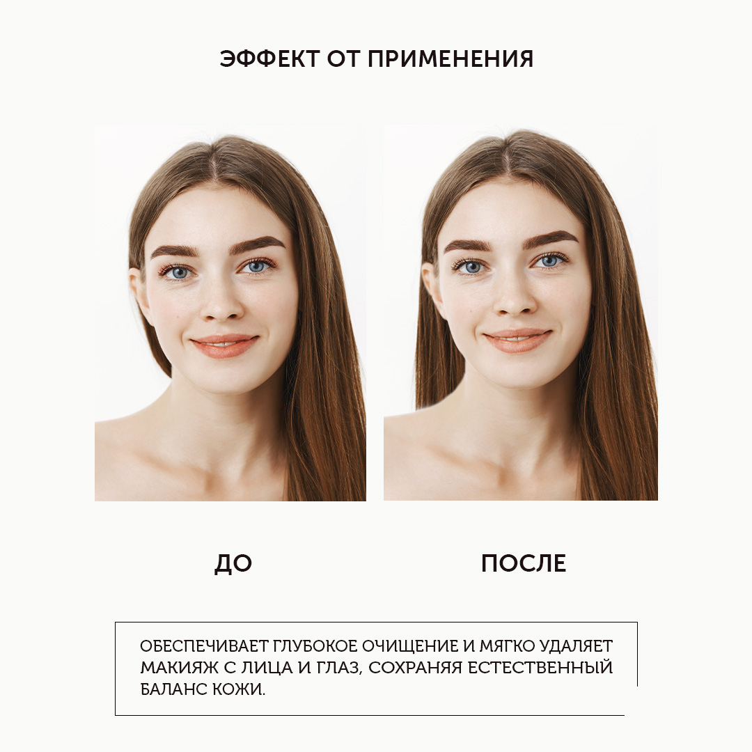 Мицеллярная вода с ниацинамидом и цинком для глубокого очищения и снятия макияжа INTENSE SOS