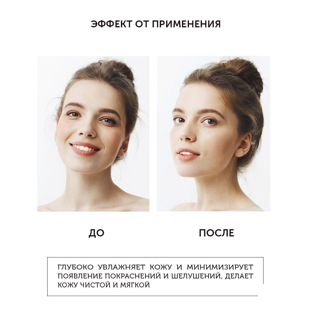 Мицеллярная вода с церамидами для глубокого очищения и снятия макияжа CALM EXPERT