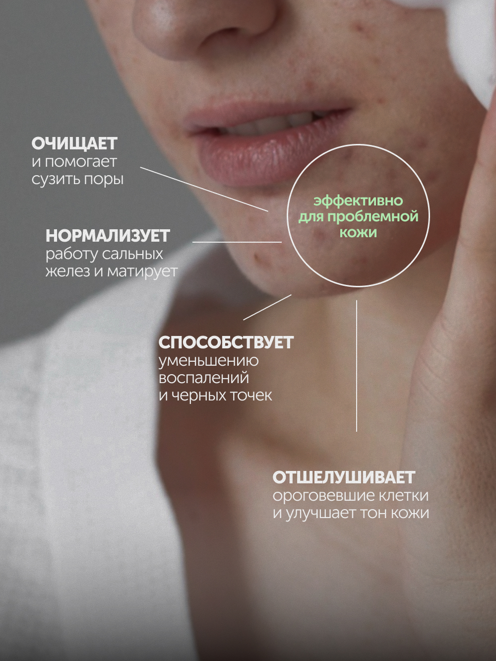 Очищающий гель для умывания INTENSE SOS с AHA+PHA+BHA кислотами