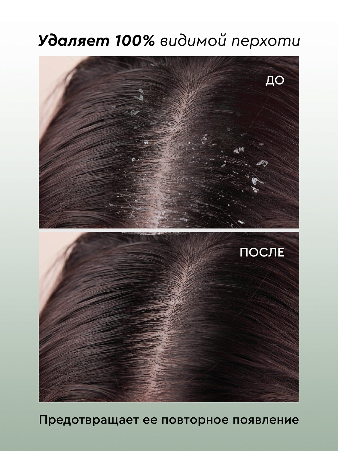 Сыворотка-концентрат для кожи головы СВЕЖАЯ МЯТА против зуда и перхоти 