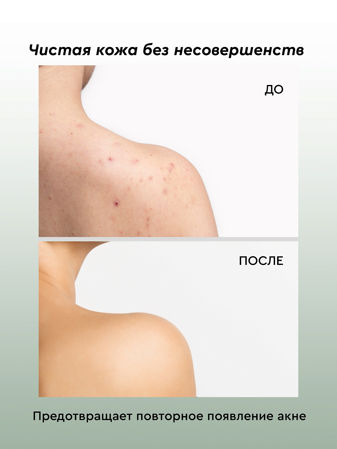 Гель для проблемной кожи СВЕЖАЯ МЯТА с маслом Чайного дерева для душа