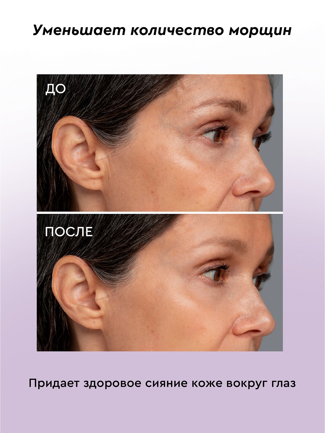 Омолаживающая сыворотка ANTI-AGE для кожи вокруг глаз против мимических морщин
