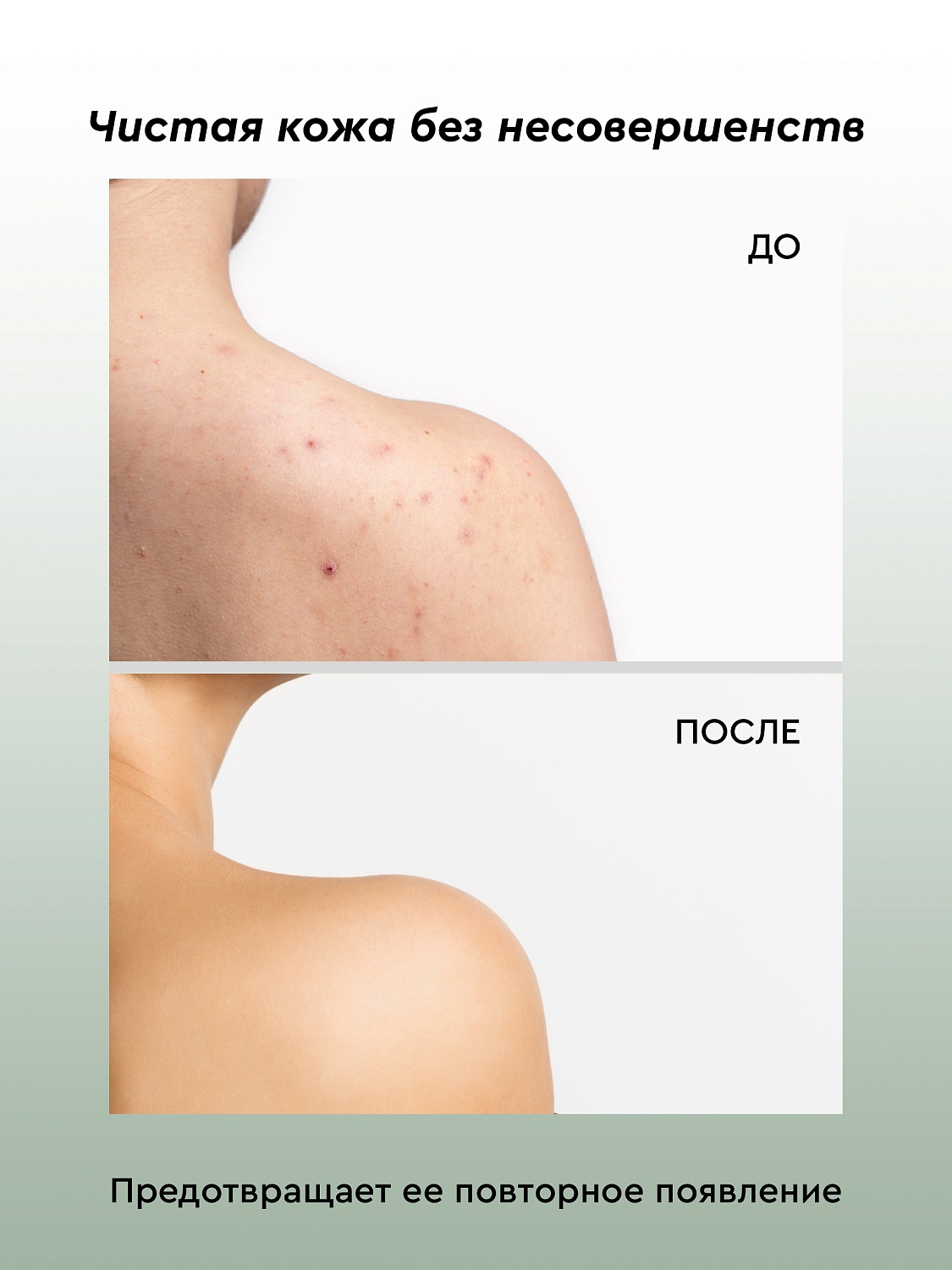 Крем-лосьон для проблемной кожи тела с комплексом EverGuard