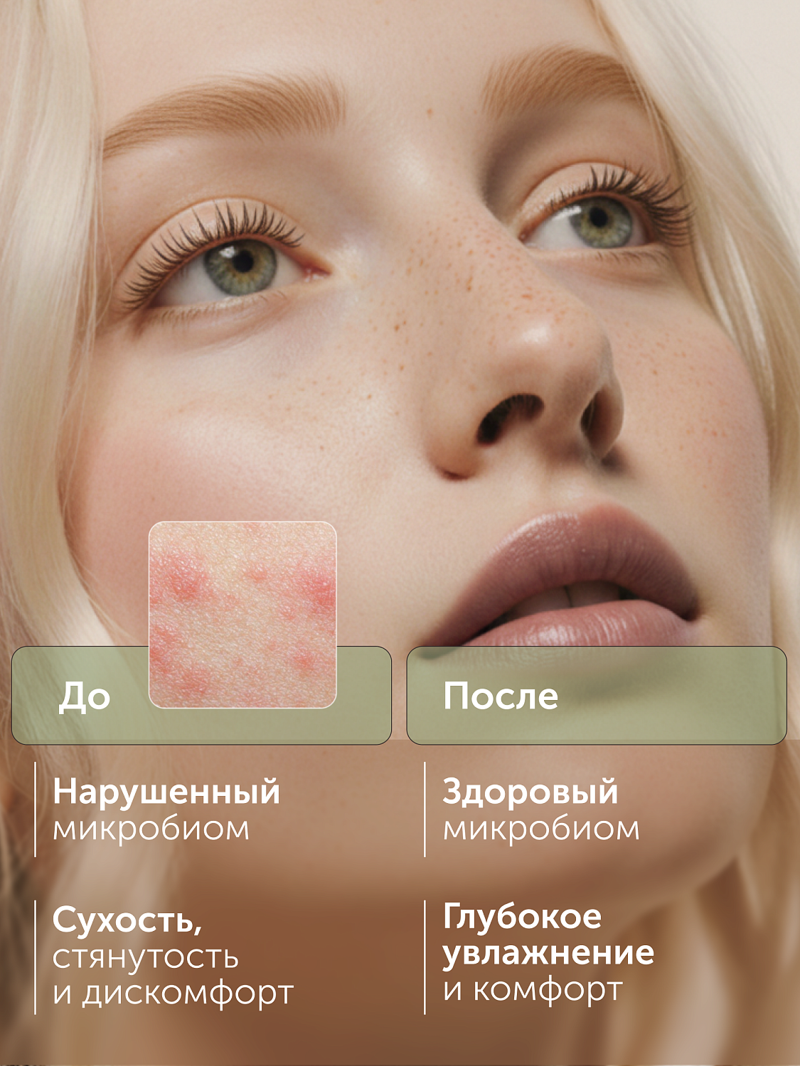 Успокаивающий тонер CALM EXPERT с инулином против сухости и покраснений